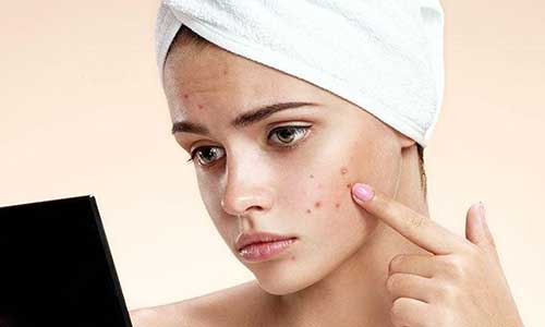 سابسیژن چیست؟