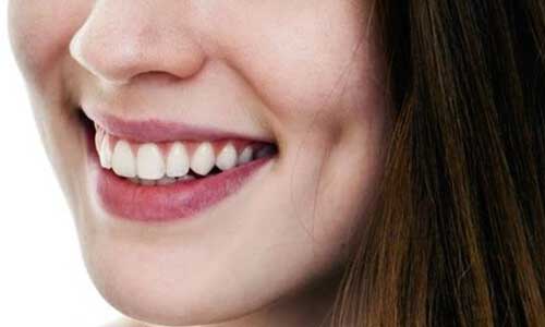 چال گونه در کلینیک آرتا