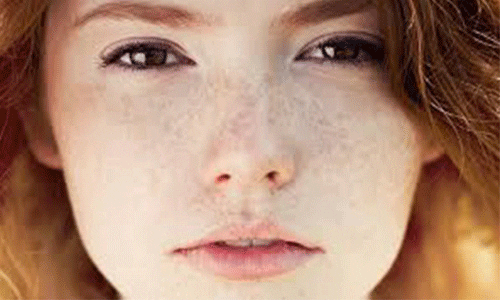 دستگاه آی پی ال
